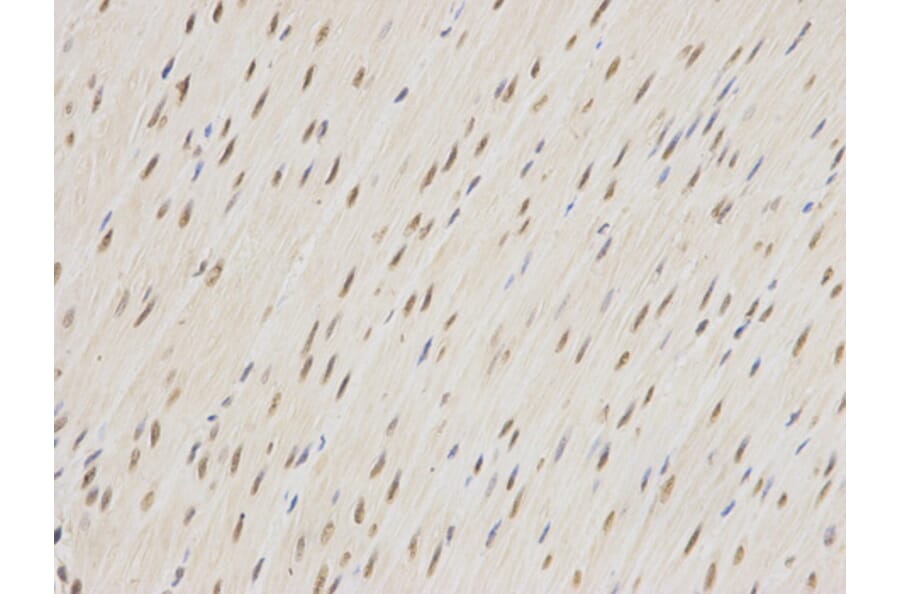 Immunohistochemistry - ZEB1 antibody from Signalway Antibody (38675) - Antibodies.com