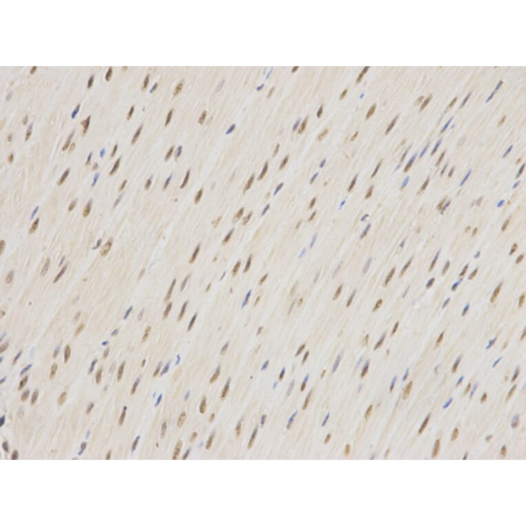 Immunohistochemistry - ZEB1 antibody from Signalway Antibody (38675) - Antibodies.com