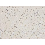 Immunohistochemistry - ZEB1 antibody from Signalway Antibody (38675) - Antibodies.com