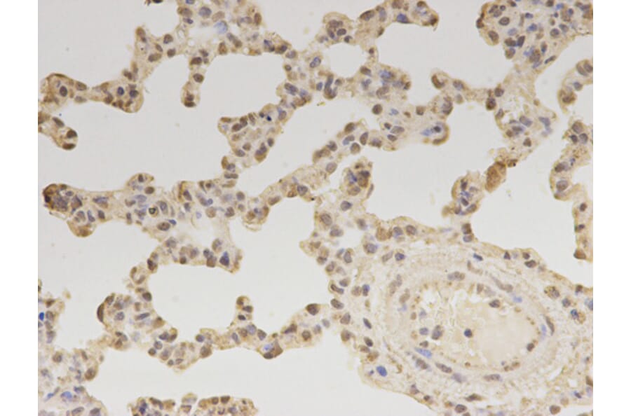 Immunohistochemistry - ZEB1 antibody from Signalway Antibody (38675) - Antibodies.com