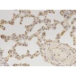 Immunohistochemistry - ZEB1 antibody from Signalway Antibody (38675) - Antibodies.com
