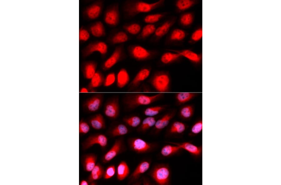 Immunofluorescence - ZEB1 antibody from Signalway Antibody (38675) - Antibodies.com