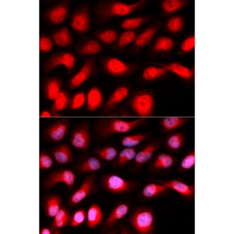 Immunofluorescence - ZEB1 antibody from Signalway Antibody (38675) - Antibodies.com
