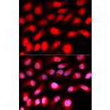 Immunofluorescence - ZEB1 antibody from Signalway Antibody (38675) - Antibodies.com