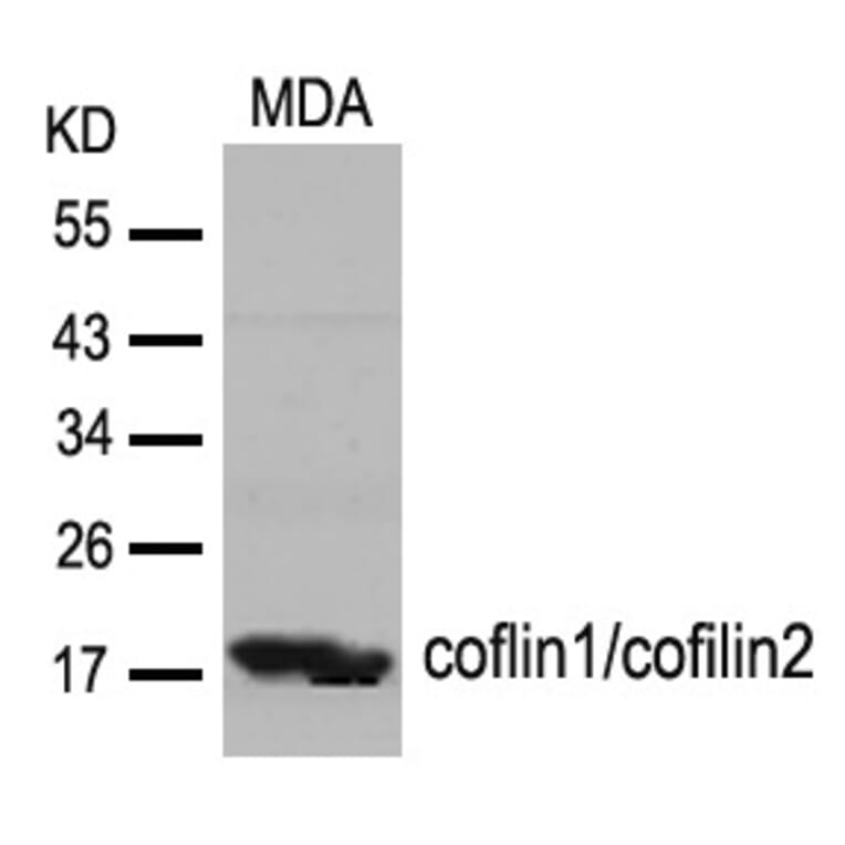 Western blot - cofilin1/cofilin2 (Ab-88) Antibody from Signalway Antibody (21507) - Antibodies.com