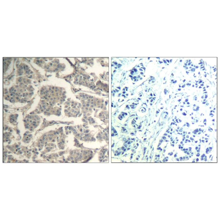 Immunohistochemistry - cofilin1/cofilin2 (Ab-88) Antibody from Signalway Antibody (21507) - Antibodies.com