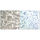 Immunohistochemistry - cofilin1/cofilin2 (Ab-88) Antibody from Signalway Antibody (21507) - Antibodies.com