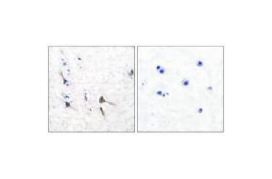 Immunohistochemistry - Potassium Channel Kv3.2b Antibody from Signalway Antibody (33473) - Antibodies.com
