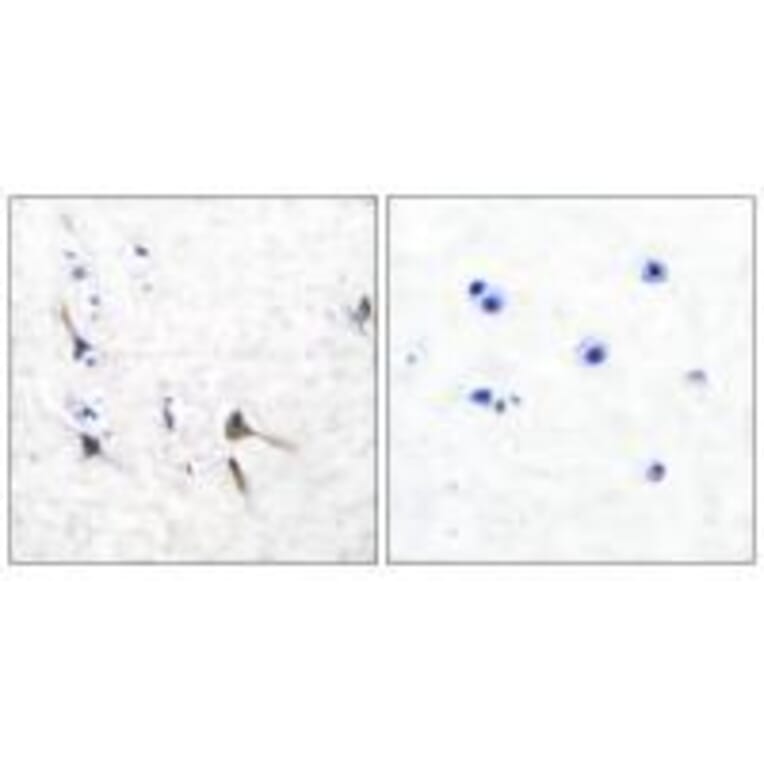 Immunohistochemistry - Potassium Channel Kv3.2b Antibody from Signalway Antibody (33473) - Antibodies.com