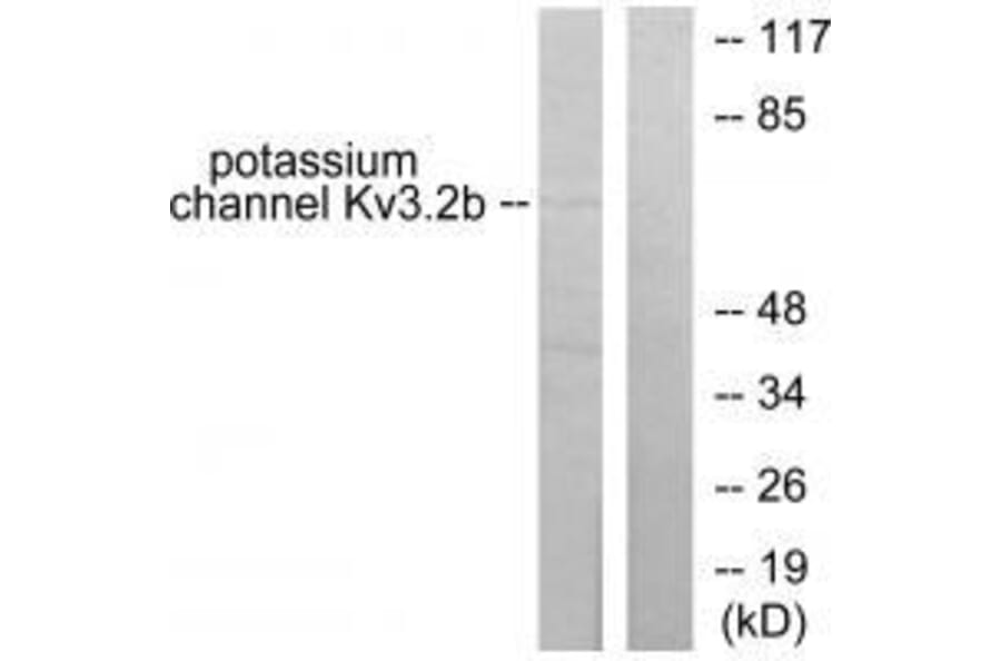 Western blot - Potassium Channel Kv3.2b Antibody from Signalway Antibody (33473) - Antibodies.com