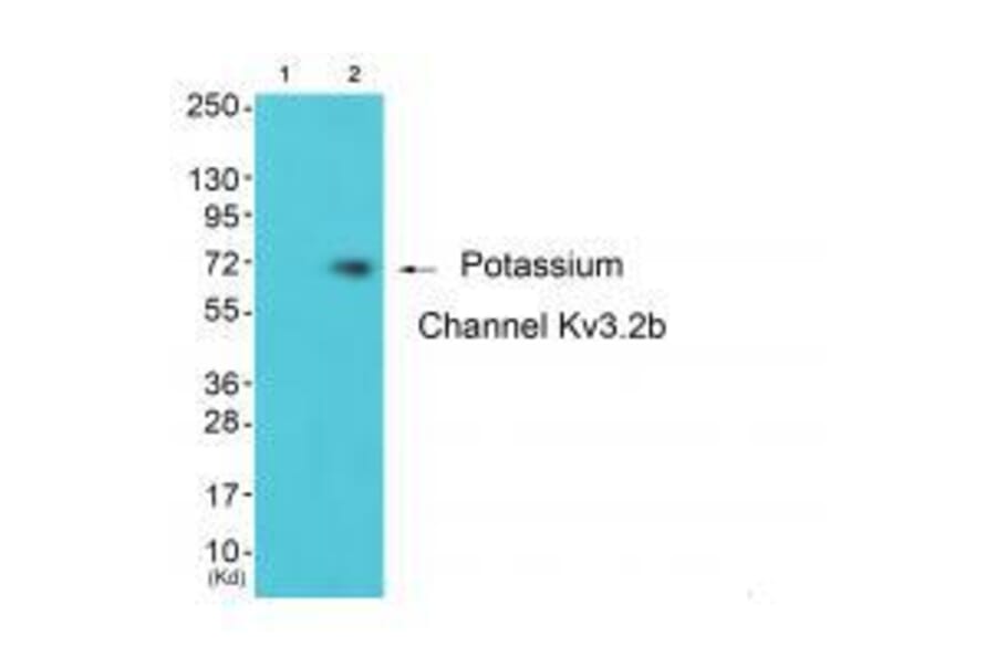 Western blot - Potassium Channel Kv3.2b Antibody from Signalway Antibody (33473) - Antibodies.com