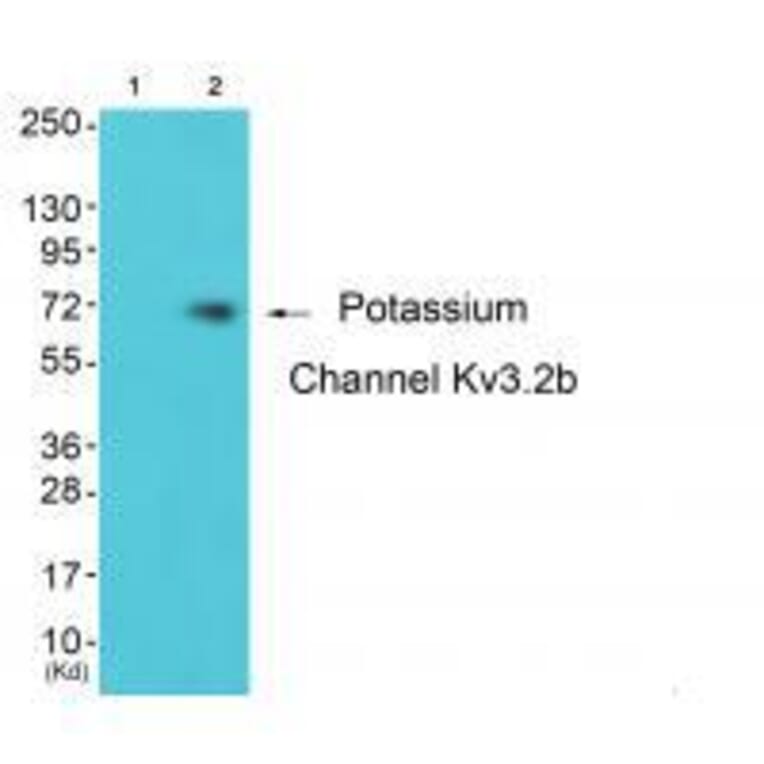 Western blot - Potassium Channel Kv3.2b Antibody from Signalway Antibody (33473) - Antibodies.com