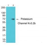 Western blot - Potassium Channel Kv3.2b Antibody from Signalway Antibody (33473) - Antibodies.com
