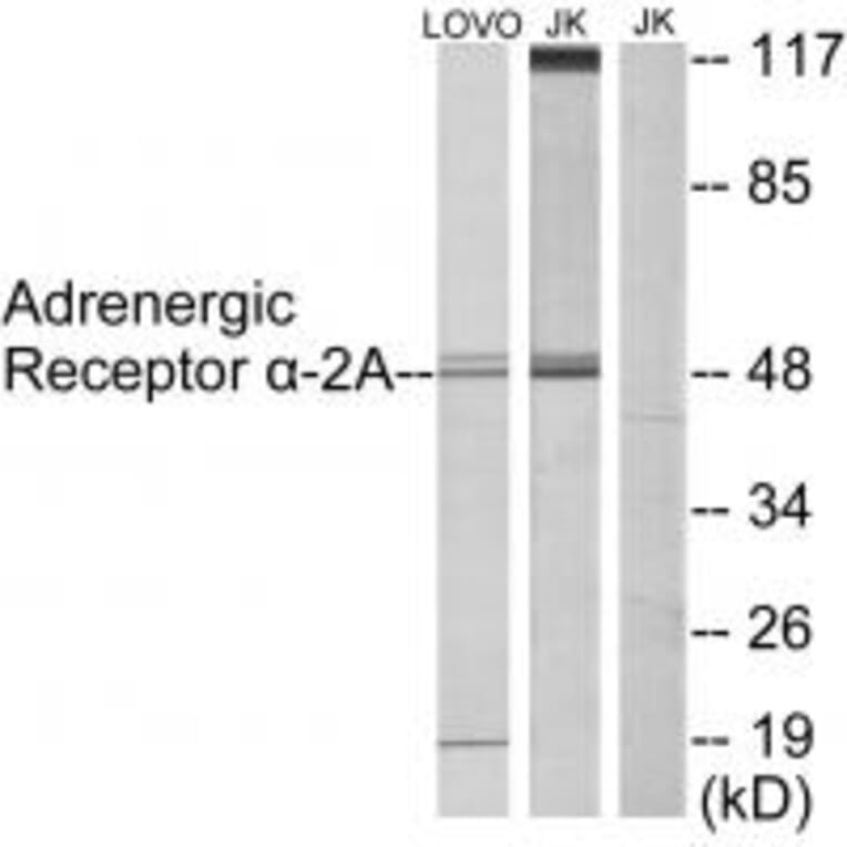 Western blot - Adrenergic Receptor α-2A Antibody from Signalway Antibody (33660) - Antibodies.com