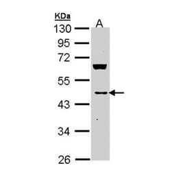 MVD antibody from Signalway Antibody (22006) - Antibodies.com