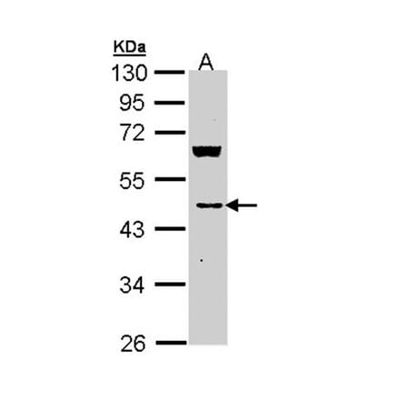 MVD antibody from Signalway Antibody (22006) - Antibodies.com