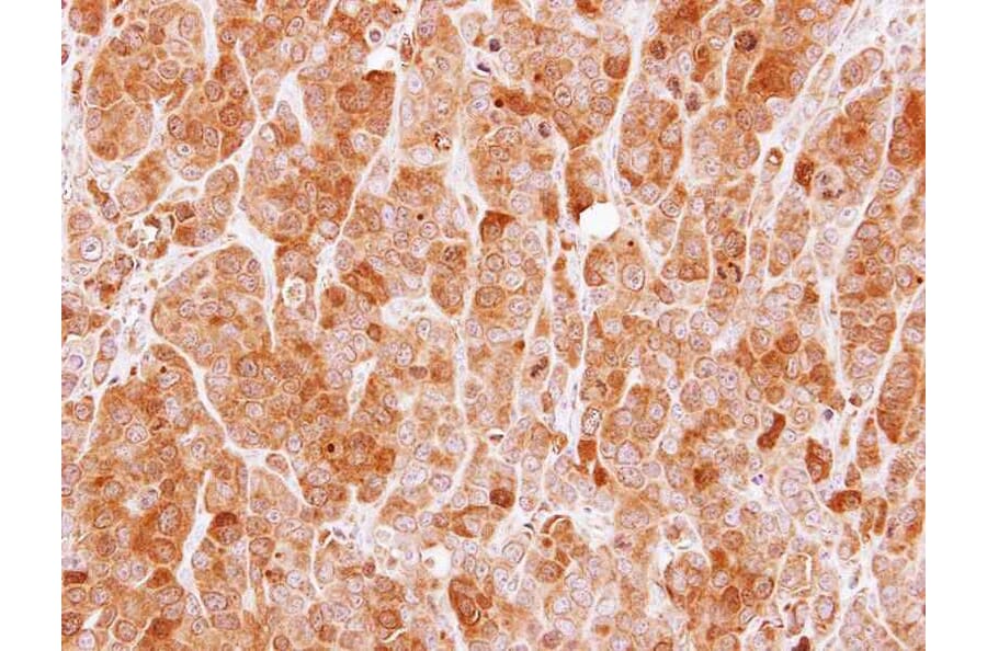 Immunohistochemistry - MVD antibody from Signalway Antibody (22006) - Antibodies.com