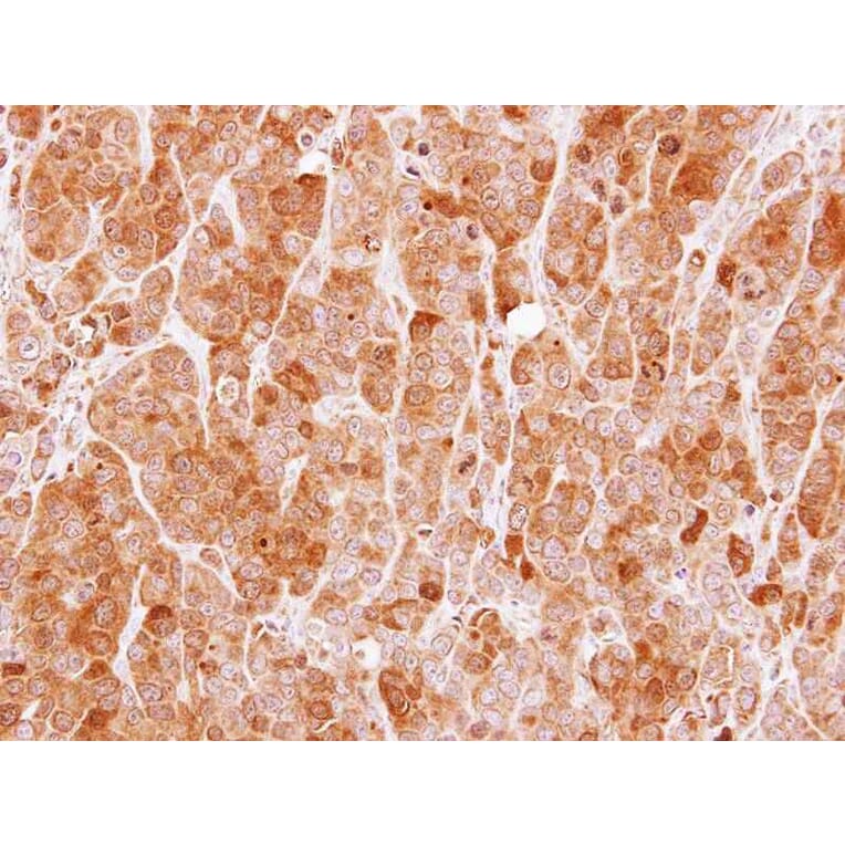 Immunohistochemistry - MVD antibody from Signalway Antibody (22006) - Antibodies.com
