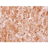 Immunohistochemistry - MVD antibody from Signalway Antibody (22006) - Antibodies.com