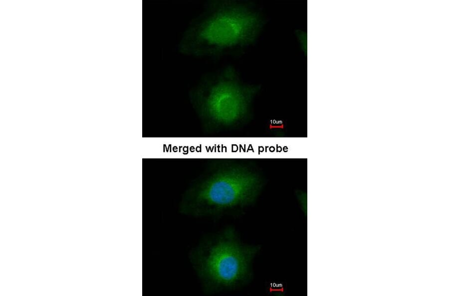 Immunofluorescence - MVD antibody from Signalway Antibody (22006) - Antibodies.com