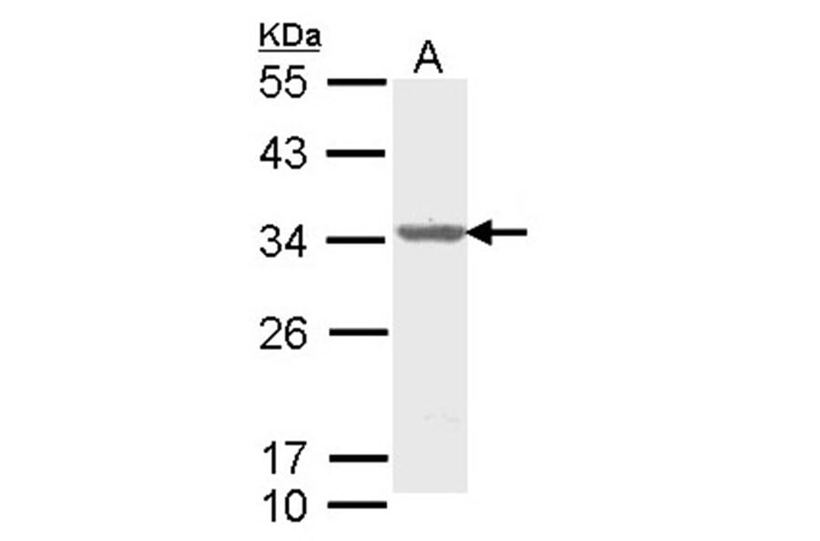 ALY antibody from Signalway Antibody (22019) - Antibodies.com