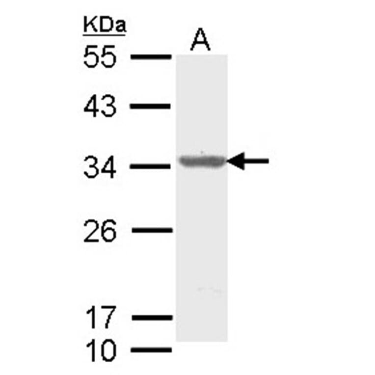 ALY antibody from Signalway Antibody (22019) - Antibodies.com