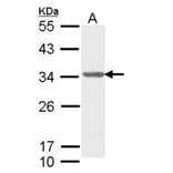 ALY antibody from Signalway Antibody (22019) - Antibodies.com