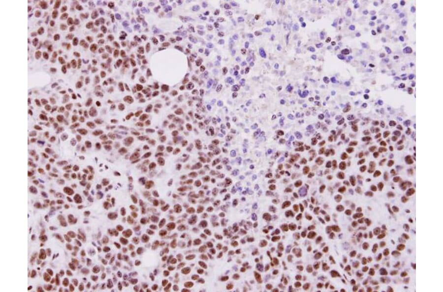 Immunohistochemistry - ALY antibody from Signalway Antibody (22019) - Antibodies.com