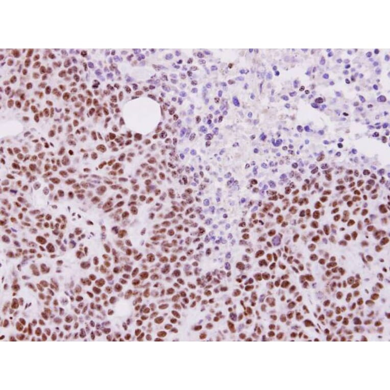 Immunohistochemistry - ALY antibody from Signalway Antibody (22019) - Antibodies.com