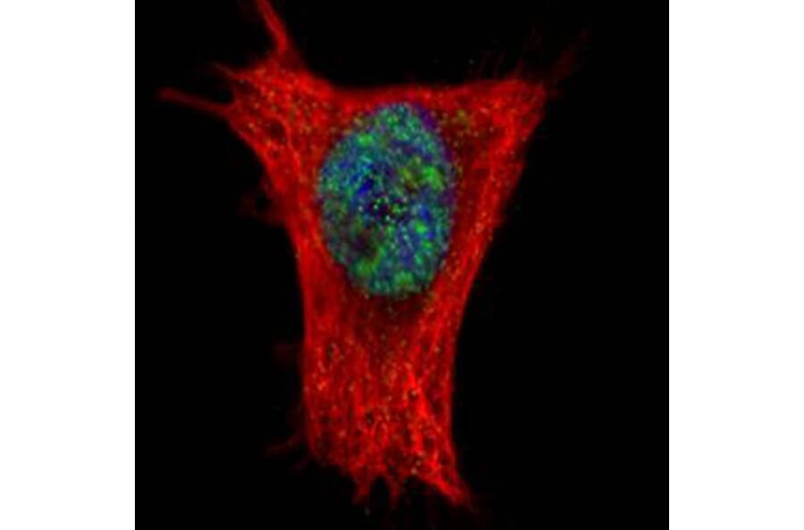 ALY antibody from Signalway Antibody (22019) - Antibodies.com