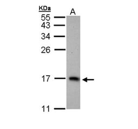 PTS antibody from Signalway Antibody (22157) - Antibodies.com