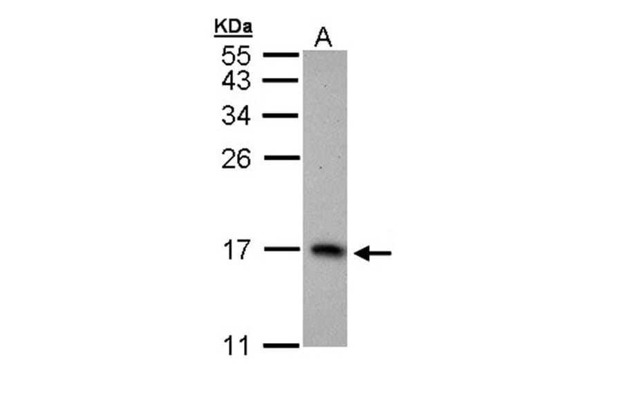 PTS antibody from Signalway Antibody (22157) - Antibodies.com