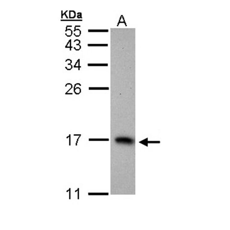 PTS antibody from Signalway Antibody (22157) - Antibodies.com