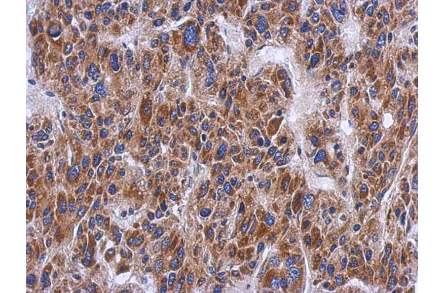 Immunohistochemistry - PTS antibody from Signalway Antibody (22157) - Antibodies.com