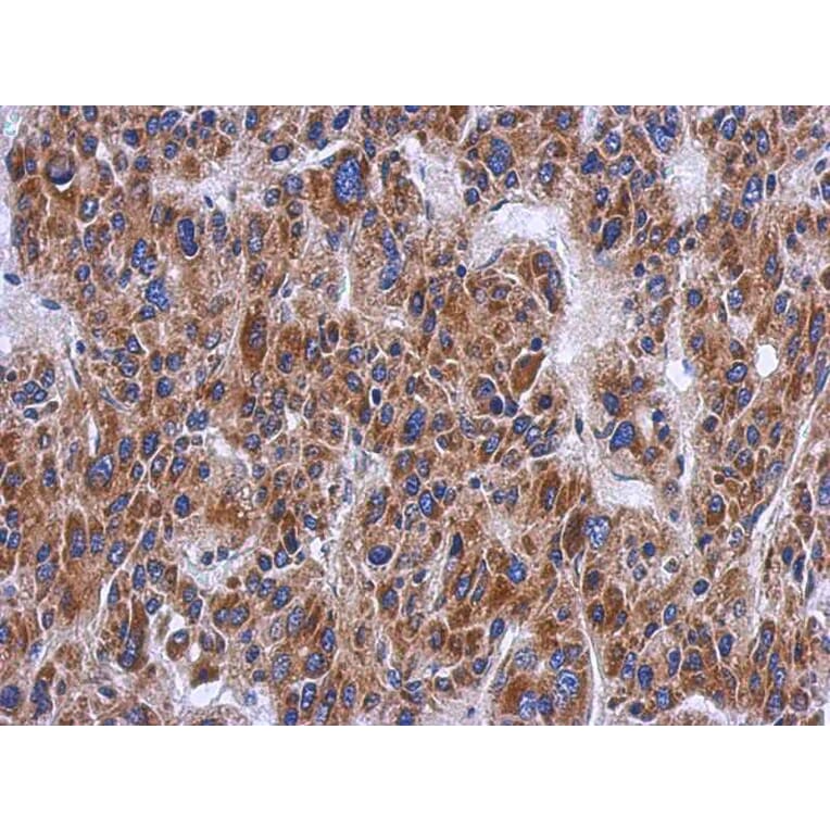 Immunohistochemistry - PTS antibody from Signalway Antibody (22157) - Antibodies.com