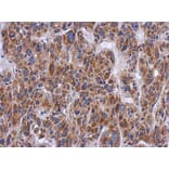 Immunohistochemistry - PTS antibody from Signalway Antibody (22157) - Antibodies.com