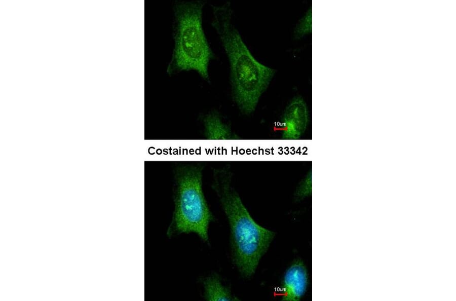 Immunofluorescence - PTS antibody from Signalway Antibody (22157) - Antibodies.com
