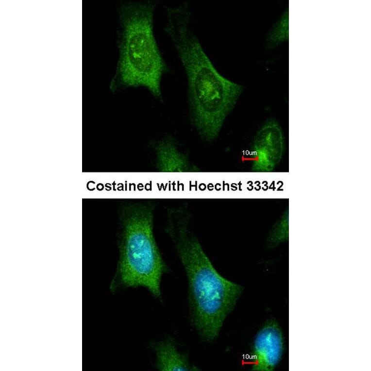 Immunofluorescence - PTS antibody from Signalway Antibody (22157) - Antibodies.com