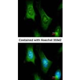 Immunofluorescence - PTS antibody from Signalway Antibody (22157) - Antibodies.com