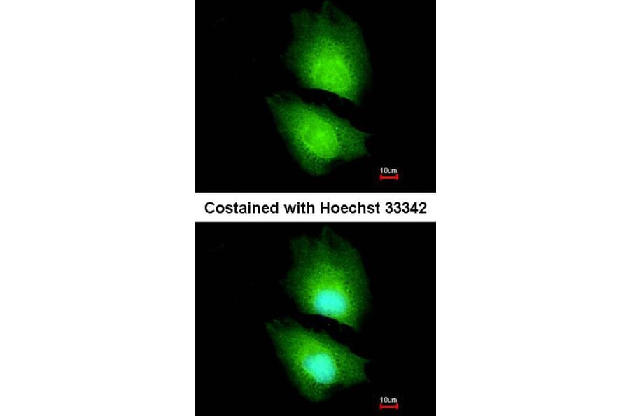 Immunofluorescence - CBS antibody from Signalway Antibody (22188) - Antibodies.com