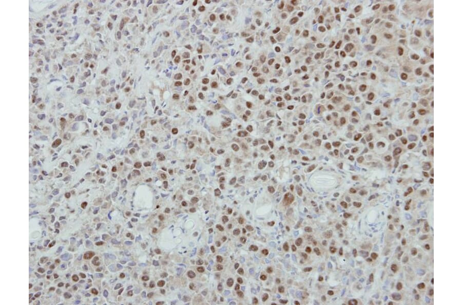 Immunohistochemistry - p84 antibody from Signalway Antibody (22511) - Antibodies.com