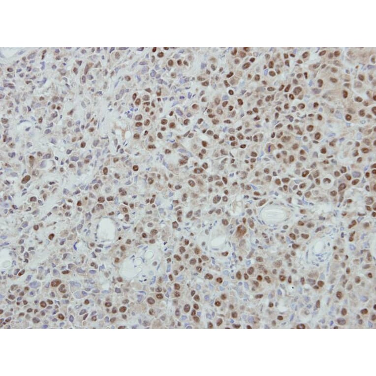 Immunohistochemistry - p84 antibody from Signalway Antibody (22511) - Antibodies.com