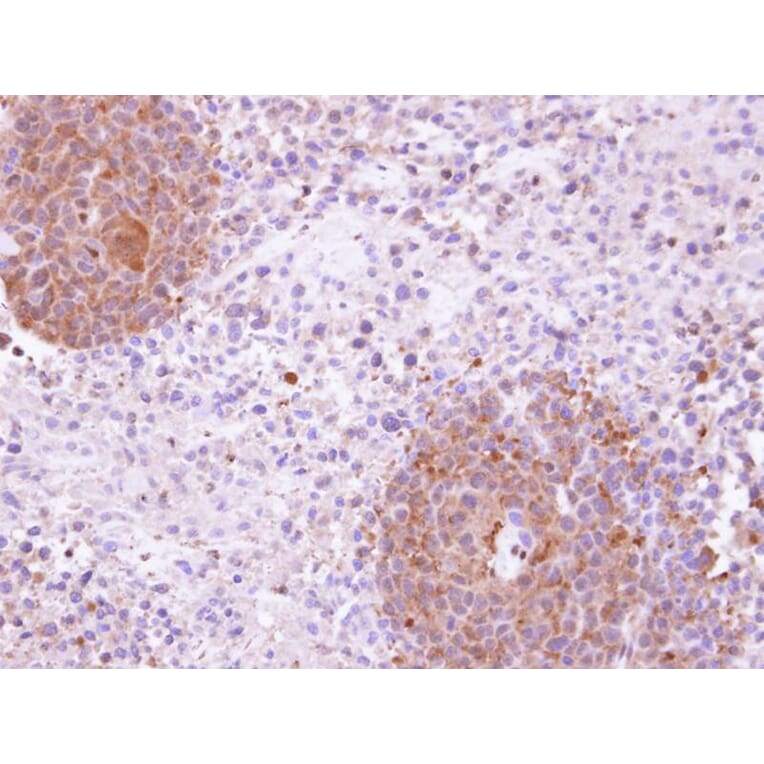 Immunohistochemistry - KHS antibody from Signalway Antibody (22583) - Antibodies.com