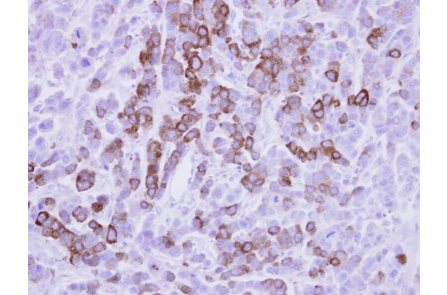 Immunohistochemistry - MX1 antibody from Signalway Antibody (22613) - Antibodies.com