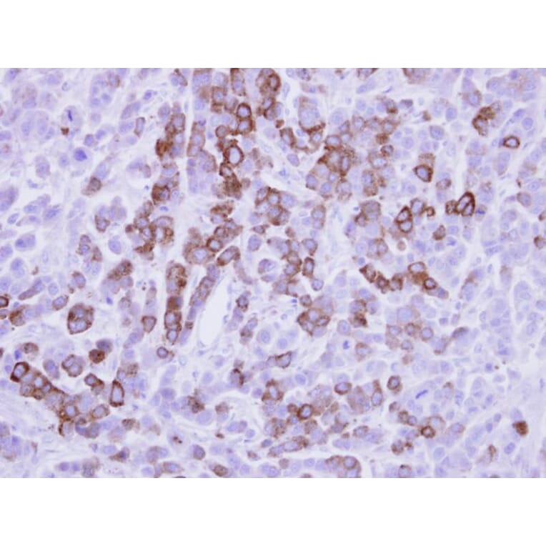 Immunohistochemistry - MX1 antibody from Signalway Antibody (22613) - Antibodies.com