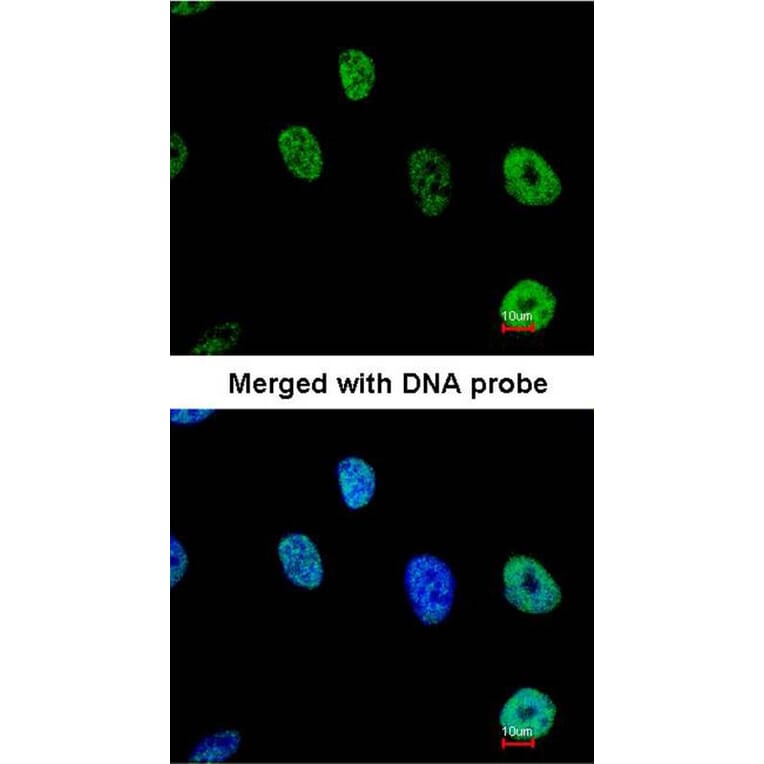 Immunofluorescence - TAP antibody from Signalway Antibody (22614) - Antibodies.com