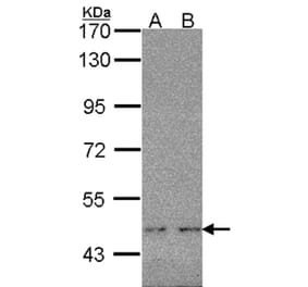 WT1 antibody from Signalway Antibody (22694) - Antibodies.com