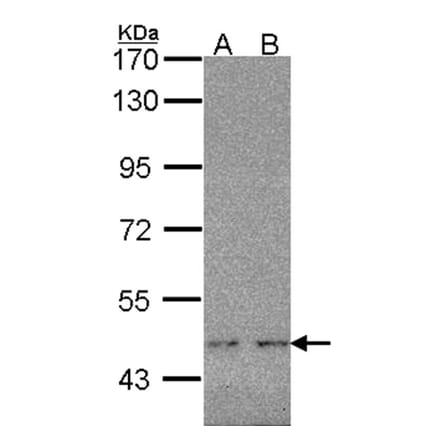 WT1 antibody from Signalway Antibody (22694) - Antibodies.com