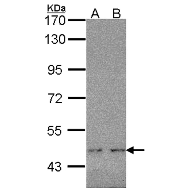 WT1 antibody from Signalway Antibody (22694) - Antibodies.com