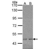 WT1 antibody from Signalway Antibody (22694) - Antibodies.com